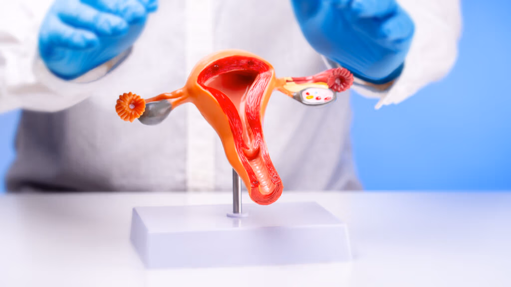 Deep Infiltrating Endometriosis: Symptoms, Diagnosis, and Treatment Options