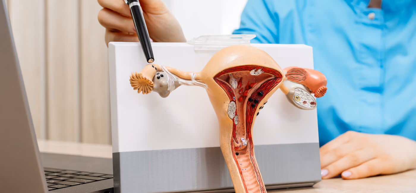 Fertility Sparing Endometriosis Surgery near Boston, Massachusetts, New England