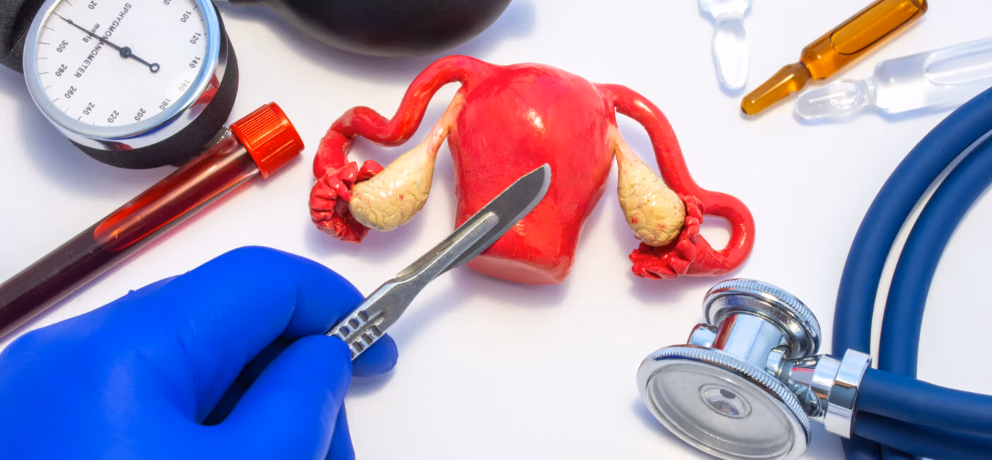 Specialized Endometrioma Excision near Boston Massachusetts, New England