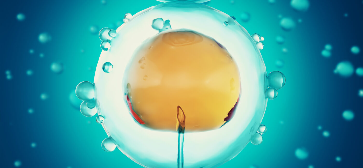 Egg Retrieval Before Endometrioma Surgery: What You Need to Know