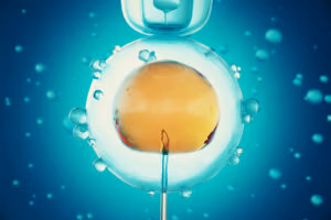 Egg Retrieval Before Endometrioma Surgery: What You Need to Know