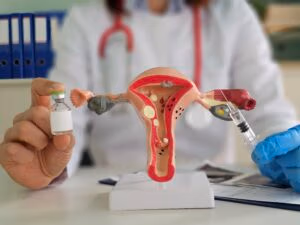 Lupron Before Fibroid Surgery: Clearing Up a Common Misconception