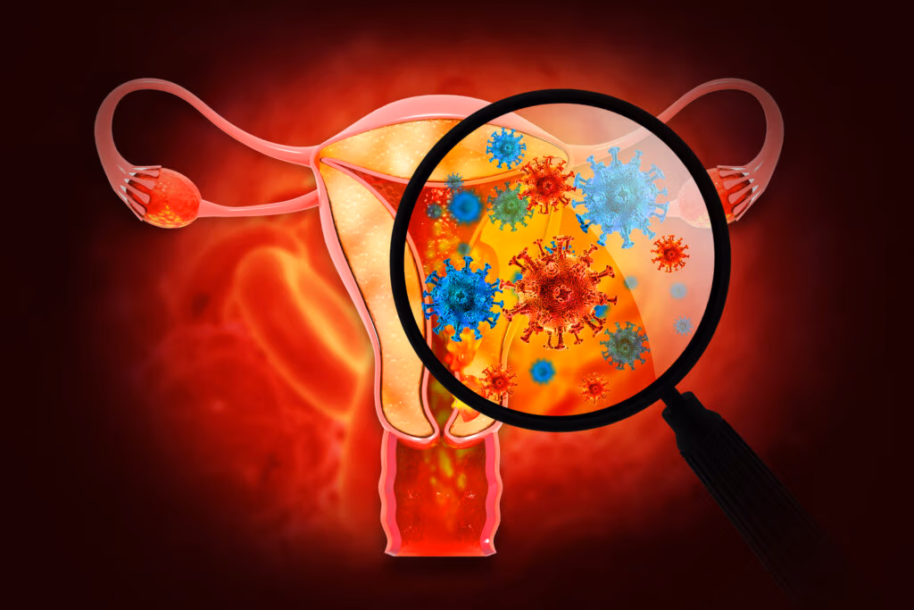 Endometriosis and Autoimmunity