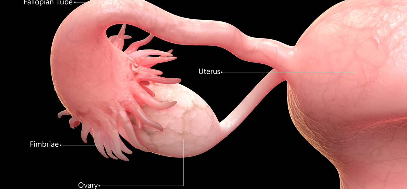 What If Ovarian Cancer Doesn’t Start in the Ovary? The Fallopian-Tube Revolution Your Surgeon Should Be Talking About