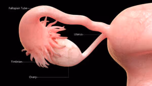 What If Ovarian Cancer Doesn't Start in the Ovary? The Fallopian-Tube Revolution Your Surgeon Should Be Talking About
